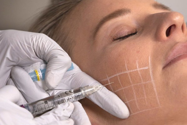 Revitalize Your Skin with Skin Booster Treatment at Skinology+ by Dr. Sheenam