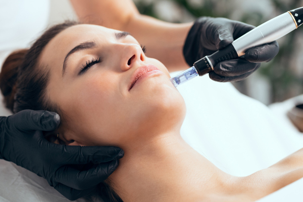 Microneedling Benefits and What to Expect During Treatment By Dr. Sheenam, Skinology+ Clinic – Best Skin Specialist in Chandigarh