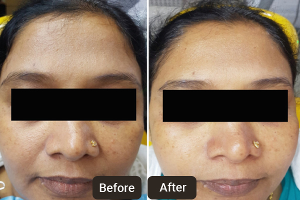 Cosmetic Dermatologists in Chandigarh | Skinology Plus Skin, Hair, Laser and Anti-aging Clinic