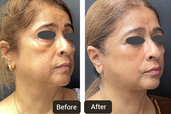 Top Skin & Laser Specialist in Chandigarh | Skinology Plus Skin, Hair, Laser and Anti-aging Clinic